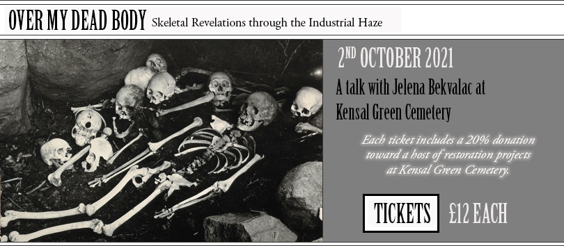 Skeletal REvelations through the Industrial Haze
